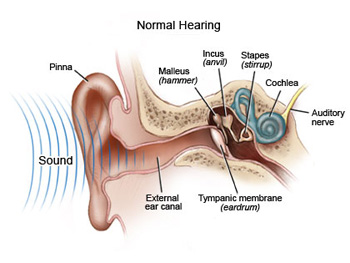 normal-hearing-diagram